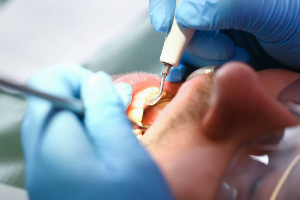 Best Walk-In Emergency Dentist in Vernon, TX